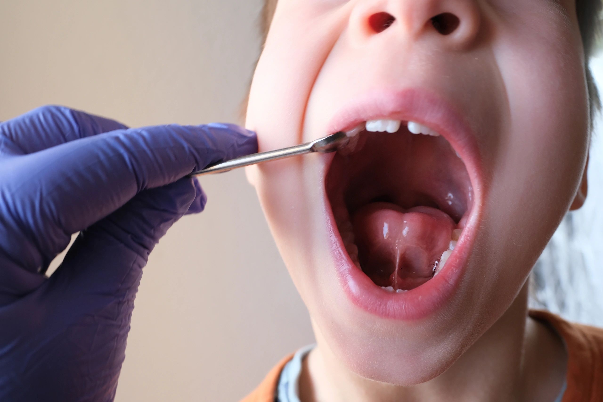 Clinical examination of child's oral cavity