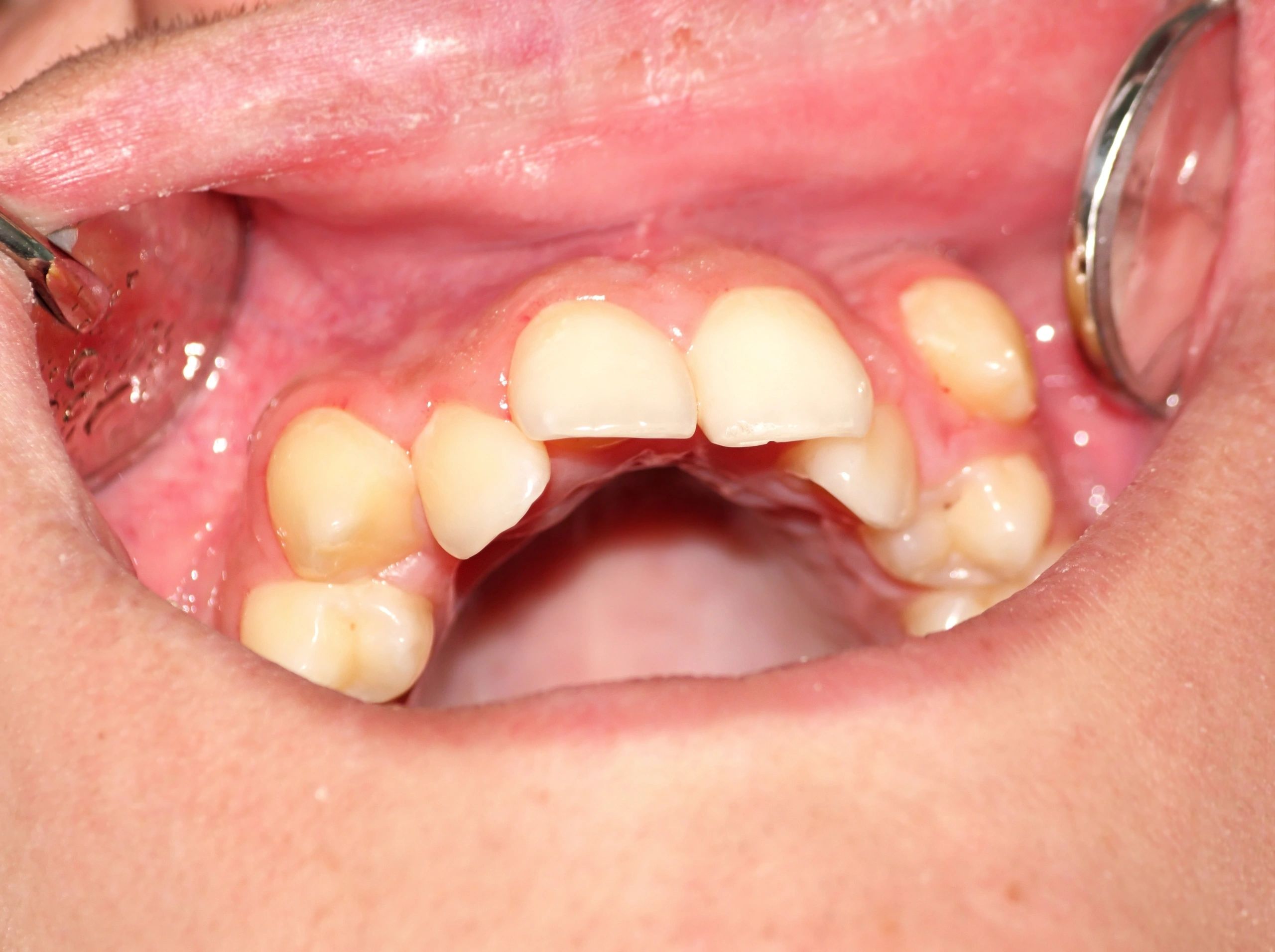 Dental photograph showing teeth and gums